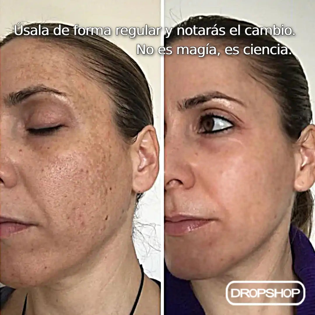 💚 Crema + Jabón Aclarador de Axilas, Zona Íntima, Rostro, Rodillas, Manos y Cuello 'Whitening Cream' [Envío Gratis - Paga en Casa] 🚛